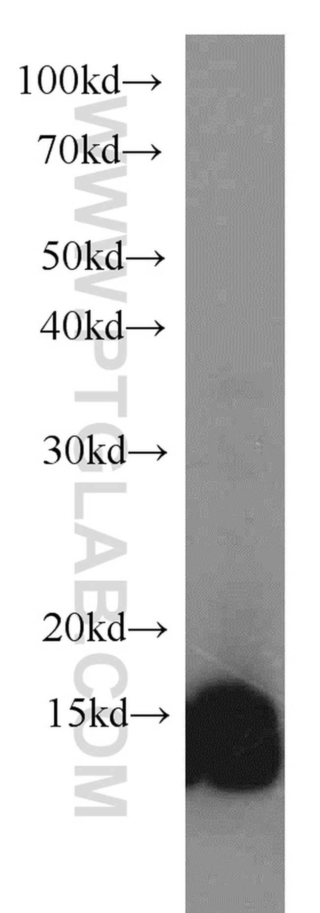 Cystatin B Antibody in Western Blot (WB)