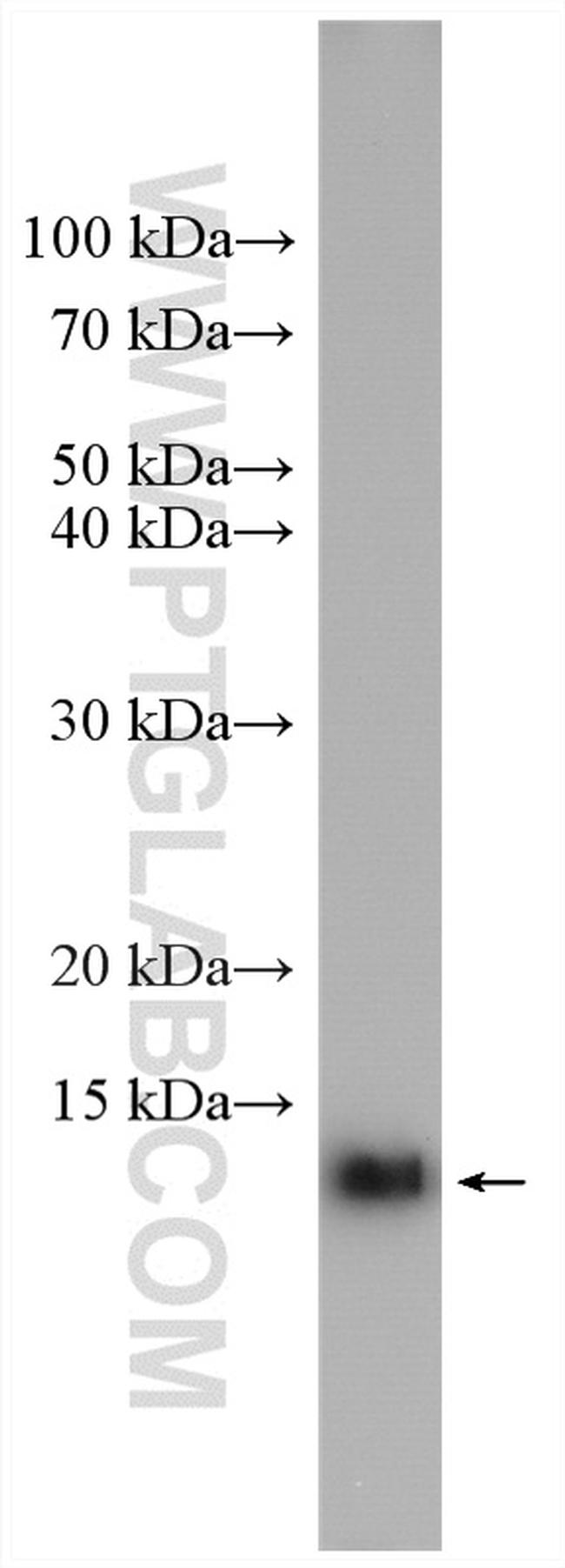 Cystatin B Antibody in Western Blot (WB)