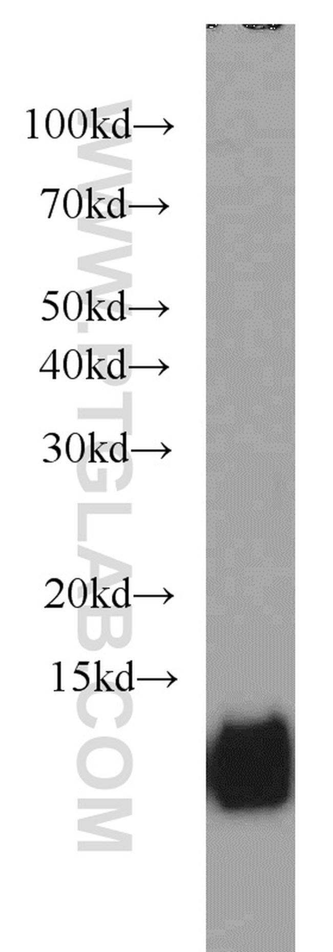 Cystatin B Antibody in Western Blot (WB)