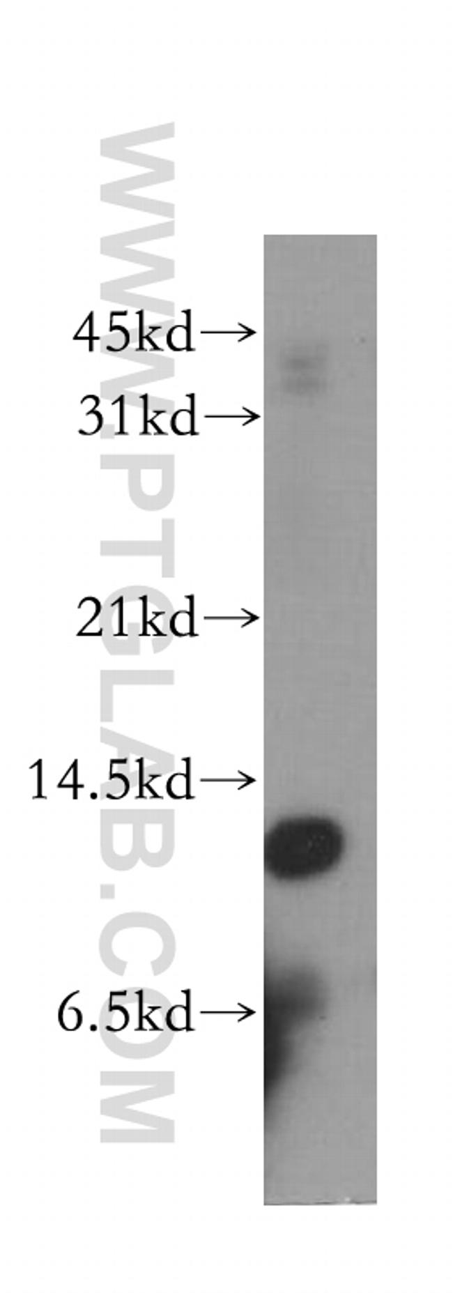 Cystatin B Antibody in Western Blot (WB)