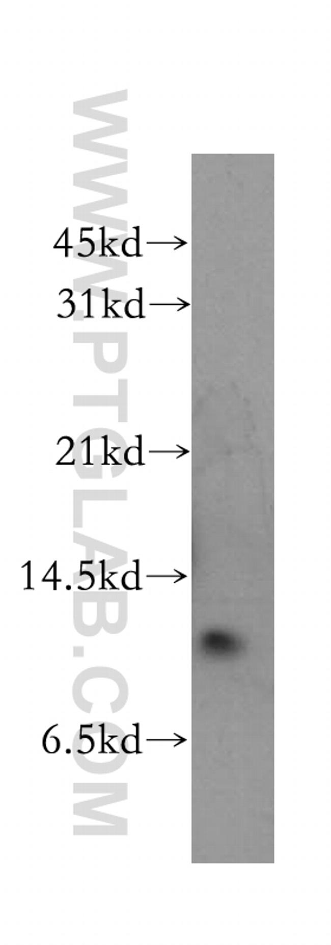 Cystatin B Antibody in Western Blot (WB)