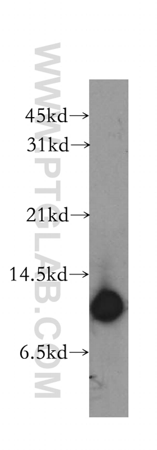 Cystatin B Antibody in Western Blot (WB)