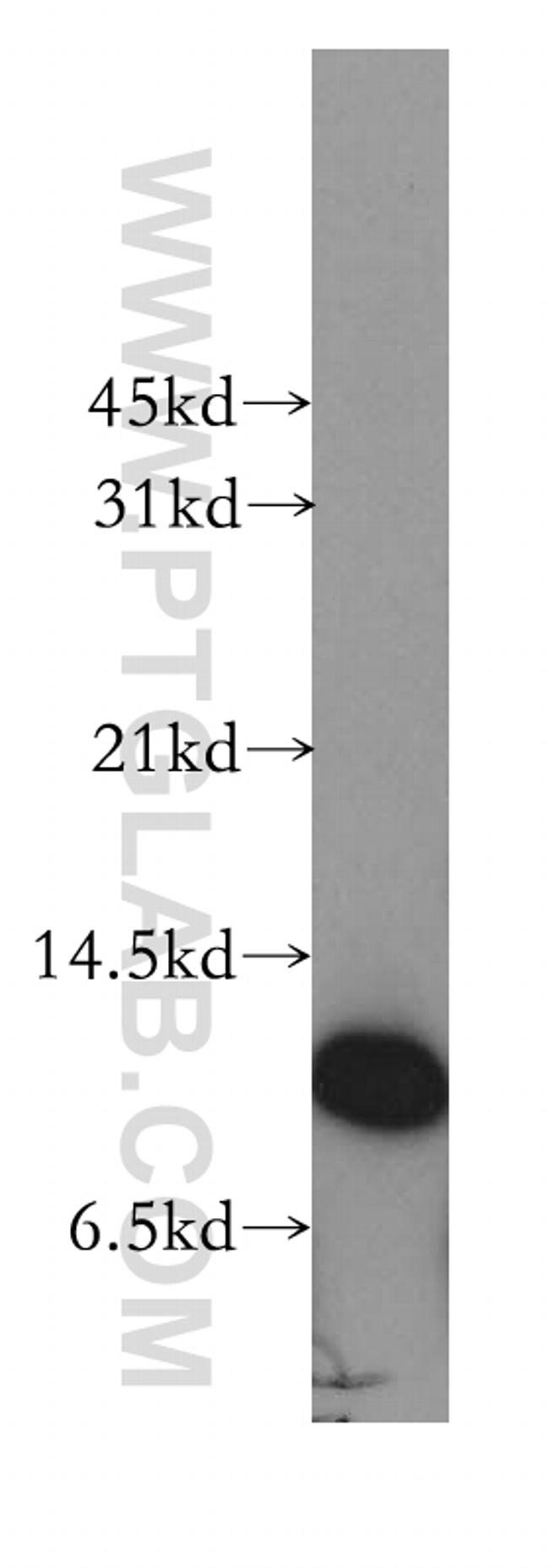 Cystatin B Antibody in Western Blot (WB)