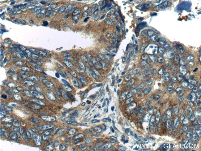 TPT1 Antibody in Immunohistochemistry (Paraffin) (IHC (P))