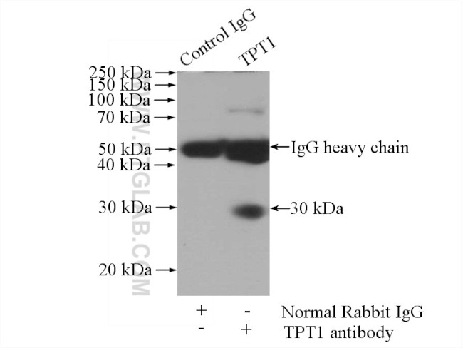 TPT1 Antibody in Immunoprecipitation (IP)