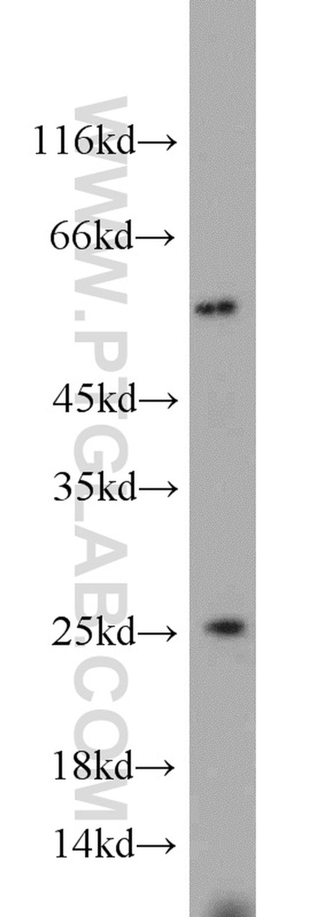 TPT1 Antibody in Western Blot (WB)