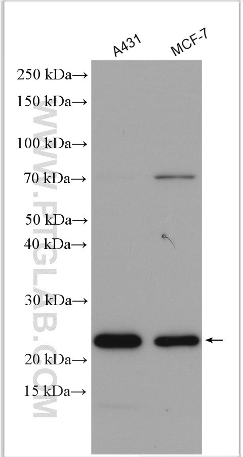 TPT1 Antibody in Western Blot (WB)