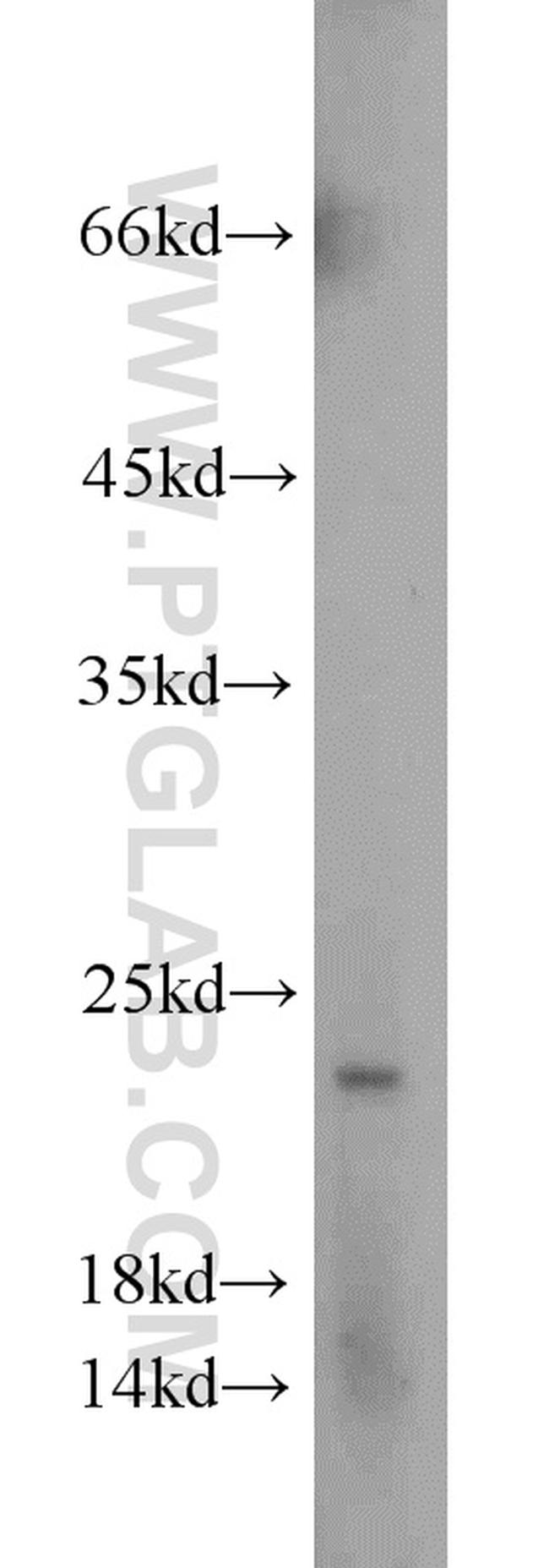 TPT1 Antibody in Western Blot (WB)