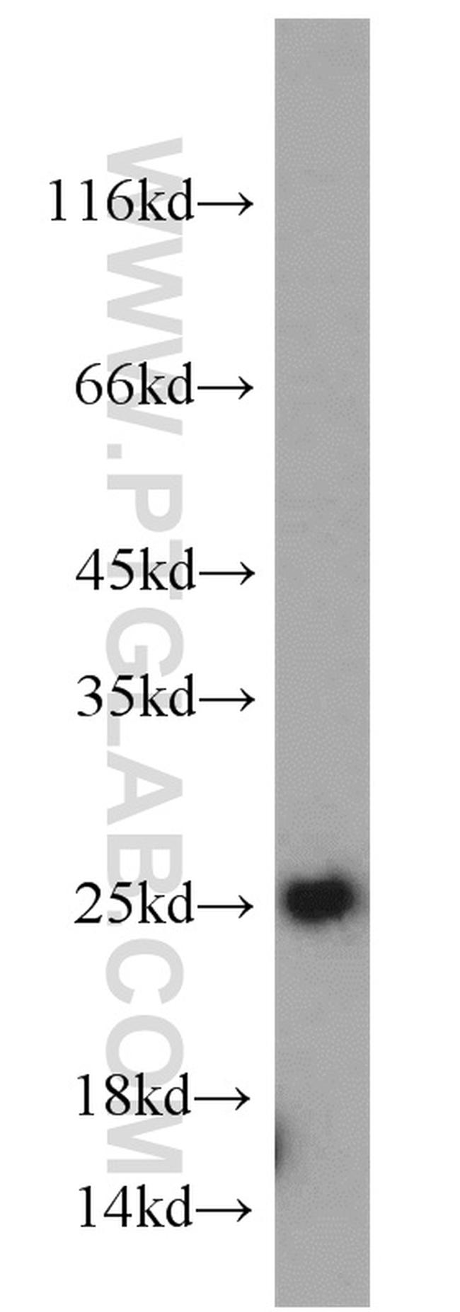 TPT1 Antibody in Western Blot (WB)