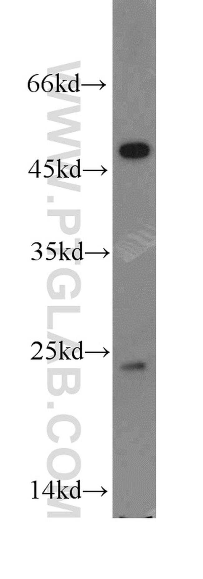 TPT1 Antibody in Western Blot (WB)