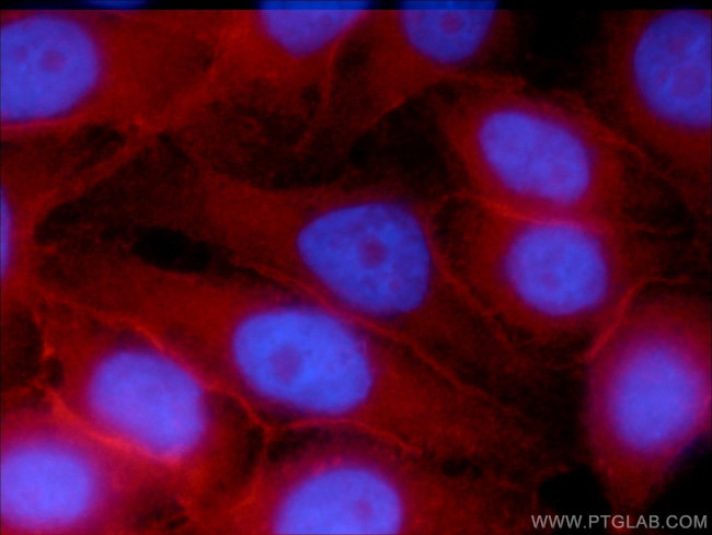 SNAP23 Antibody in Immunocytochemistry (ICC/IF)