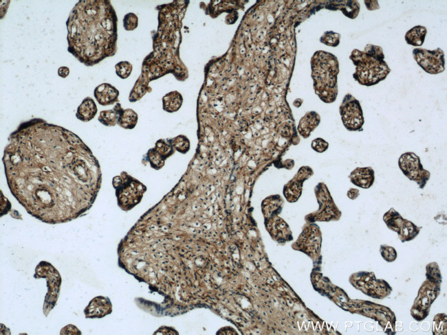 SNAP23 Antibody in Immunohistochemistry (Paraffin) (IHC (P))