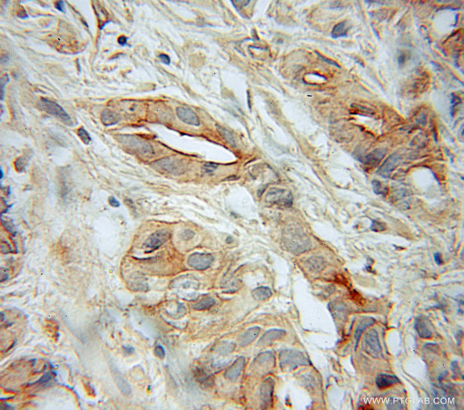 SNAP23 Antibody in Immunohistochemistry (Paraffin) (IHC (P))