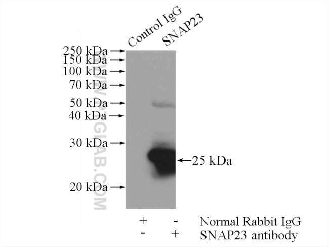 SNAP23 Antibody in Immunoprecipitation (IP)