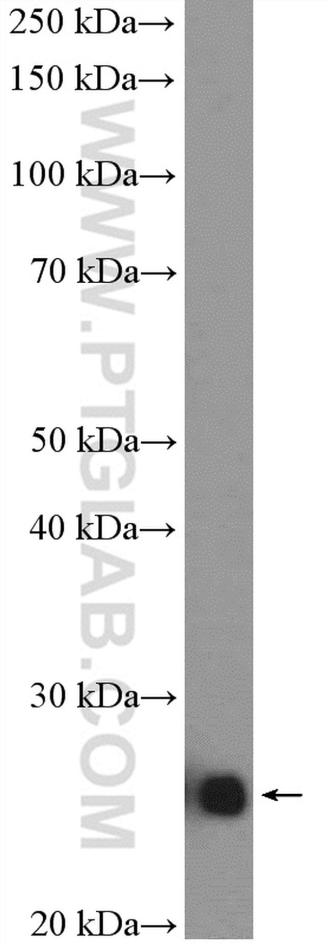 SNAP23 Antibody in Western Blot (WB)