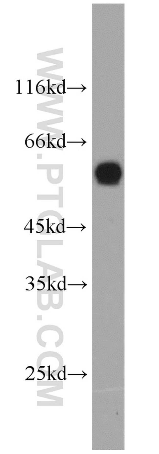 KAT5 Antibody in Western Blot (WB)