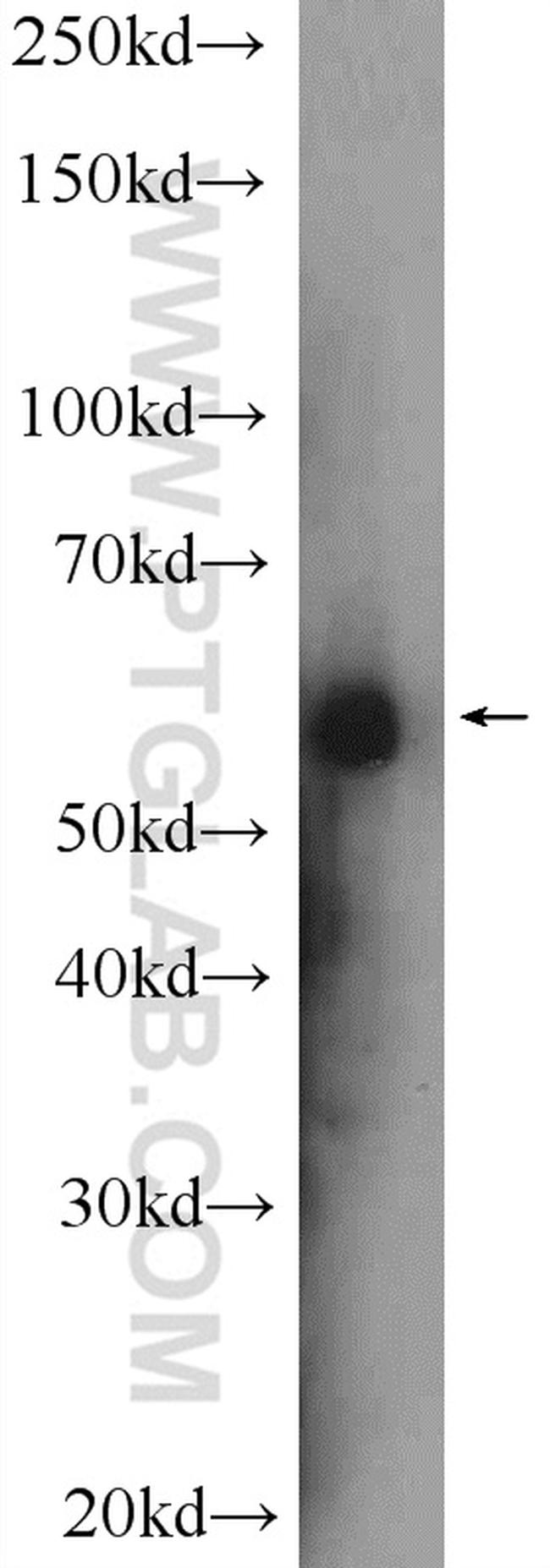 KAT5 Antibody in Western Blot (WB)