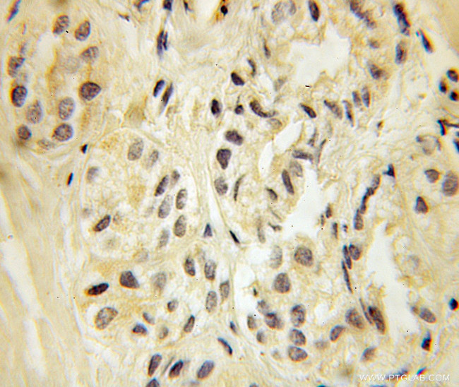 KAT5 Antibody in Immunohistochemistry (Paraffin) (IHC (P))