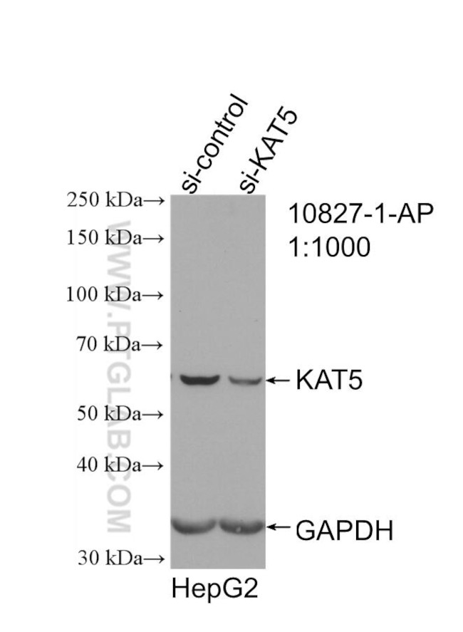 KAT5 Antibody in Western Blot (WB)