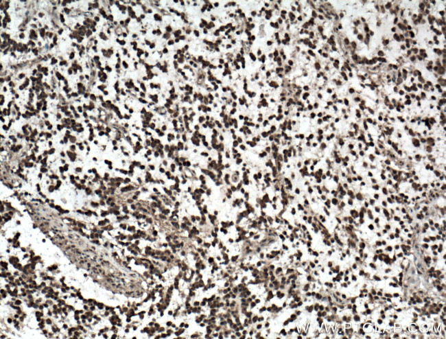 c-MYC Antibody in Immunohistochemistry (Paraffin) (IHC (P))