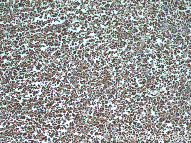 c-MYC Antibody in Immunohistochemistry (Paraffin) (IHC (P))