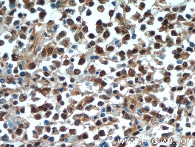 c-MYC Antibody in Immunohistochemistry (Paraffin) (IHC (P))