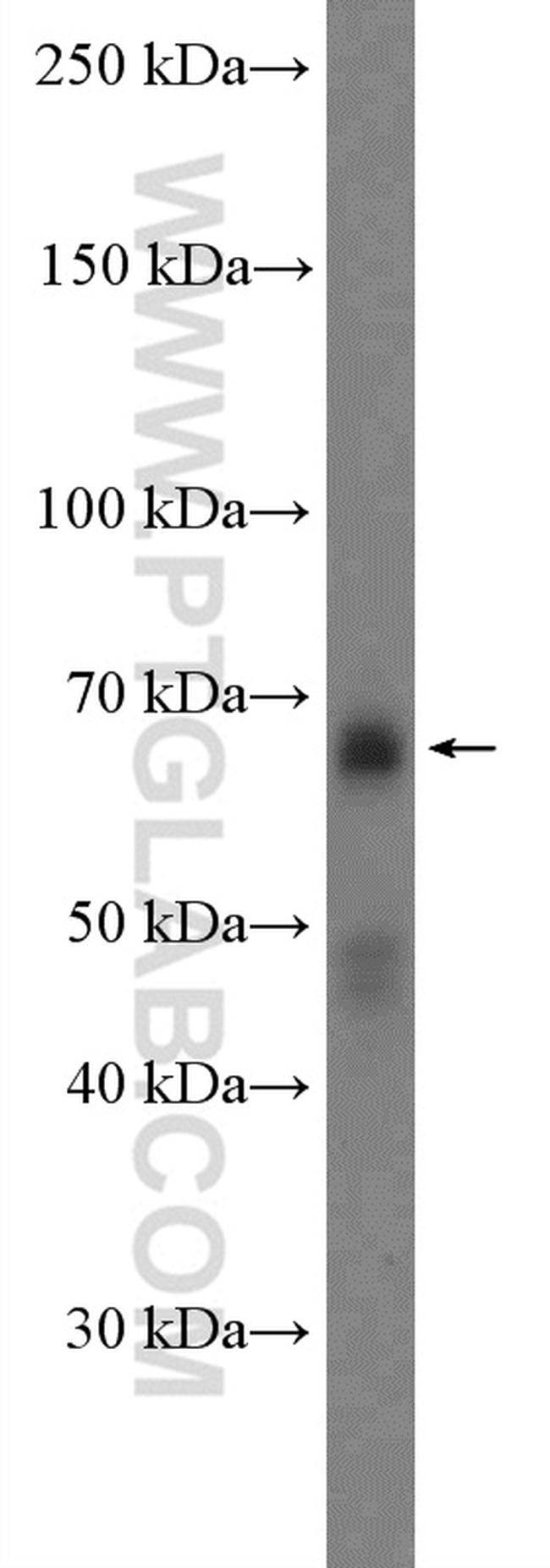 c-MYC Antibody in Western Blot (WB)