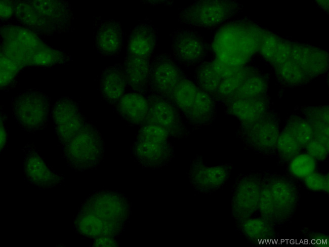 c-MYC Antibody in Immunocytochemistry (ICC/IF)