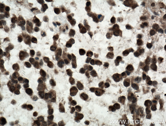 c-MYC Antibody in Immunohistochemistry (Paraffin) (IHC (P))