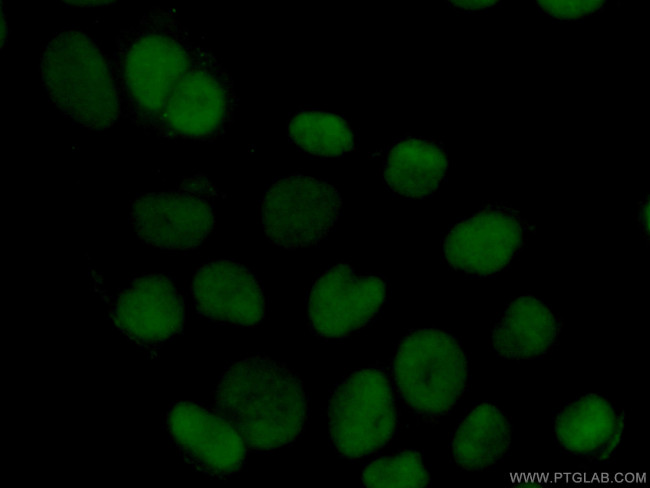 HMGB1 Antibody in Immunocytochemistry (ICC/IF)