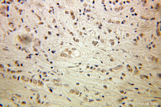 HMGB1 Antibody in Immunohistochemistry (Paraffin) (IHC (P))