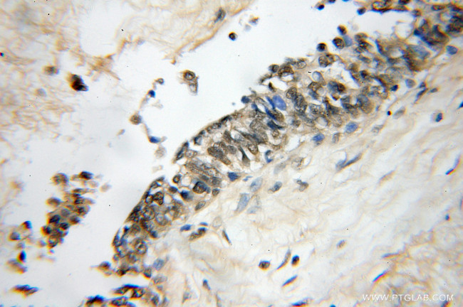 HMGB1 Antibody in Immunohistochemistry (Paraffin) (IHC (P))