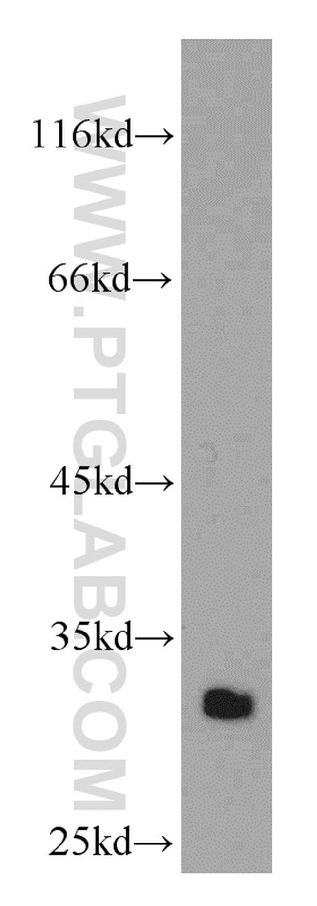 HMGB1 Antibody in Western Blot (WB)