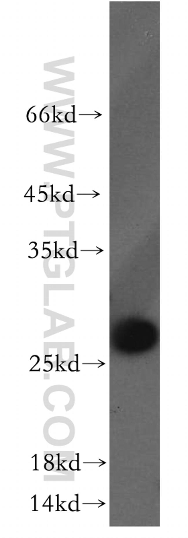 HMGB1 Antibody in Western Blot (WB)