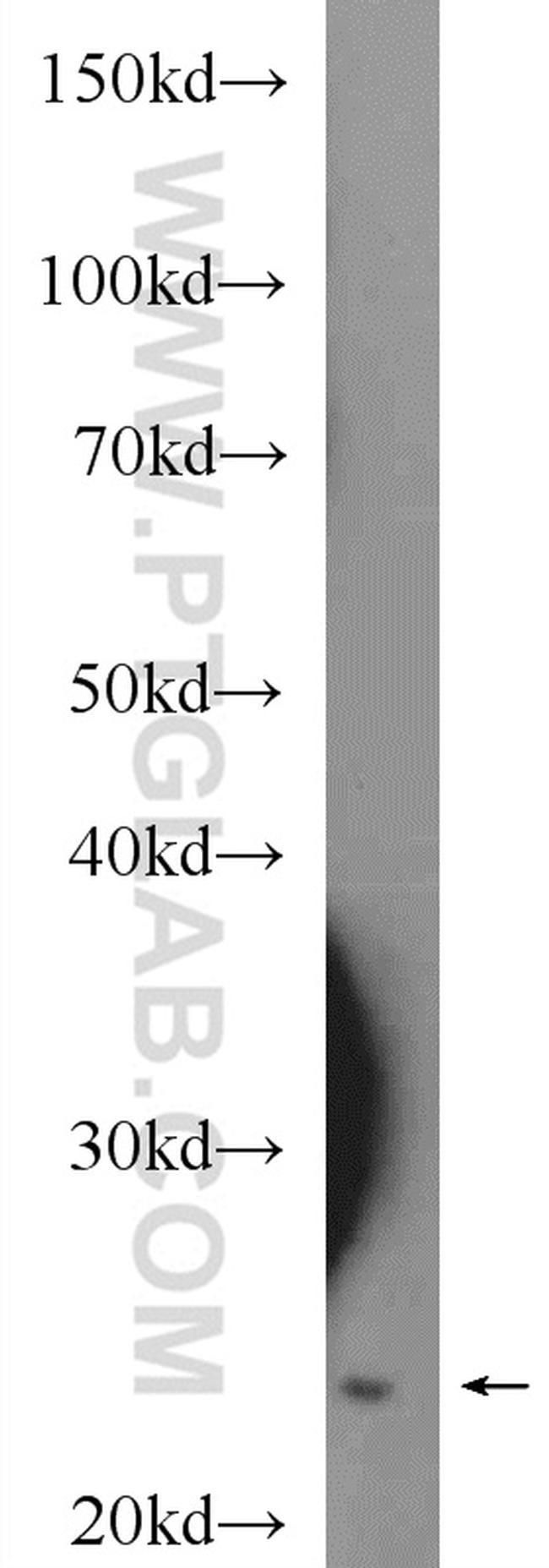 HMGB1 Antibody in Western Blot (WB)