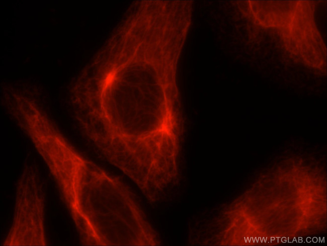 Cytokeratin 18 Antibody in Immunocytochemistry (ICC/IF)