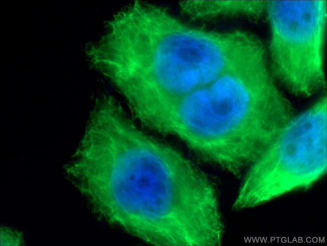 Cytokeratin 18 Antibody in Immunocytochemistry (ICC/IF)