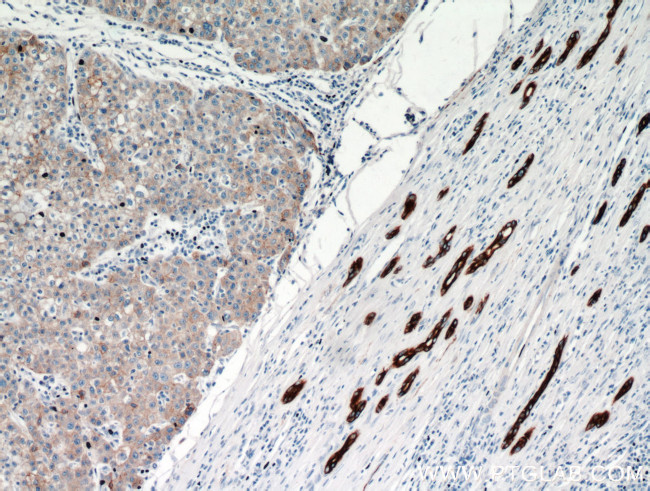 Cytokeratin 18 Antibody in Immunohistochemistry (Paraffin) (IHC (P))