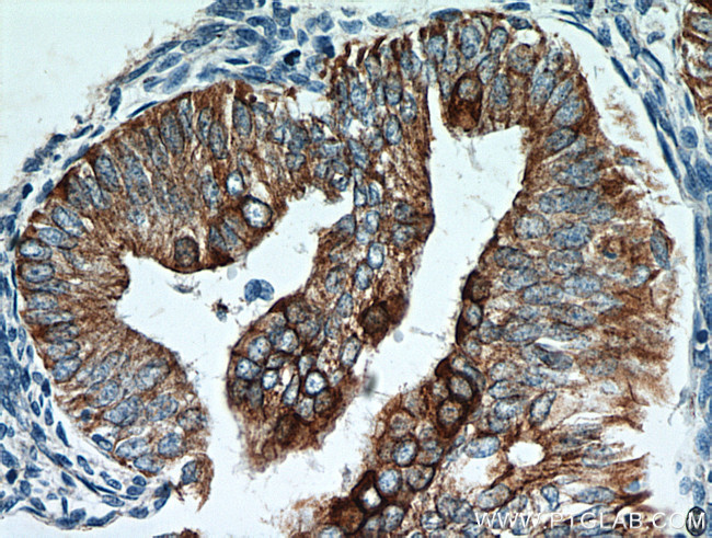 Cytokeratin 18 Antibody in Immunohistochemistry (Paraffin) (IHC (P))