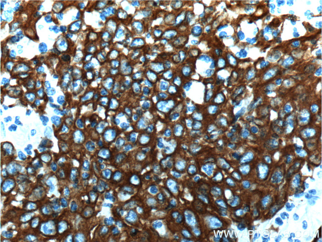 Cytokeratin 18 Antibody in Immunohistochemistry (Paraffin) (IHC (P))