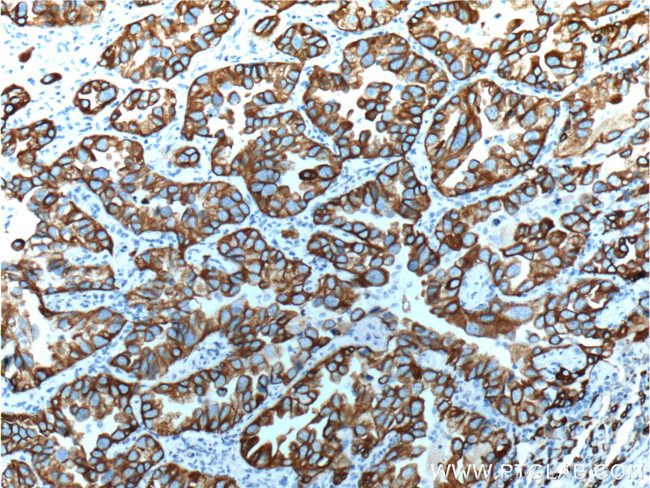 Cytokeratin 18 Antibody in Immunohistochemistry (Paraffin) (IHC (P))