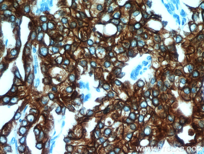 Cytokeratin 18 Antibody in Immunohistochemistry (Paraffin) (IHC (P))