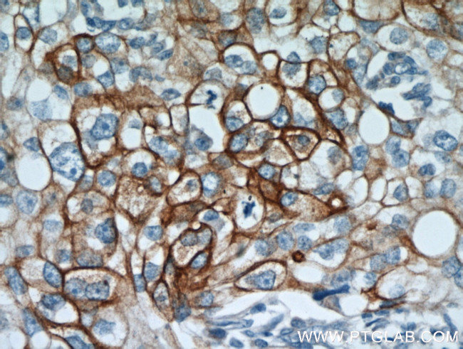 Cytokeratin 18 Antibody in Immunohistochemistry (Paraffin) (IHC (P))