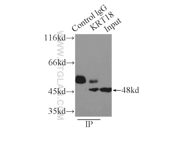 Cytokeratin 18 Antibody in Immunoprecipitation (IP)