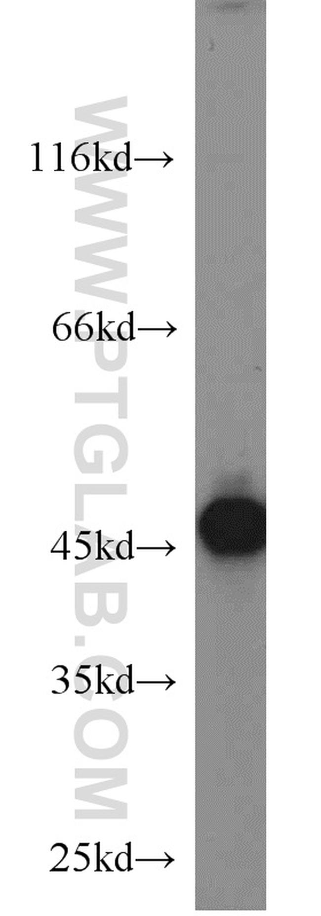 Cytokeratin 18 Antibody in Western Blot (WB)