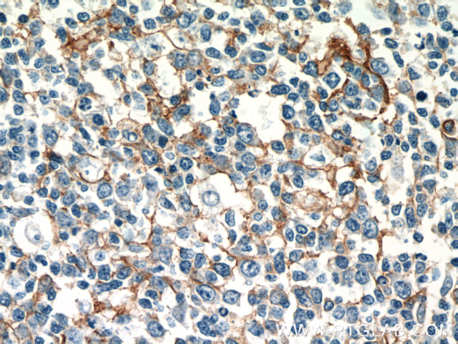 ICAM-1 Antibody in Immunohistochemistry (Paraffin) (IHC (P))
