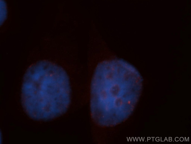 BMI1 Antibody in Immunocytochemistry (ICC/IF)