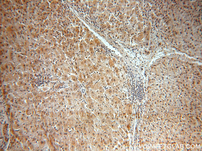 BMI1 Antibody in Immunohistochemistry (Paraffin) (IHC (P))