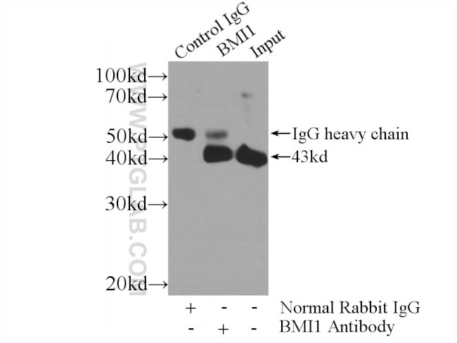 BMI1 Antibody in Immunoprecipitation (IP)