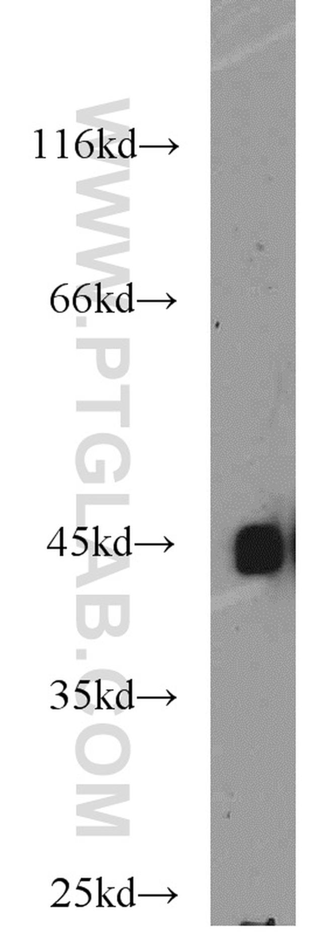 BMI1 Antibody in Western Blot (WB)